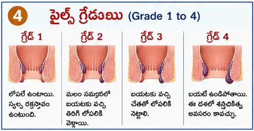Grades in Piles