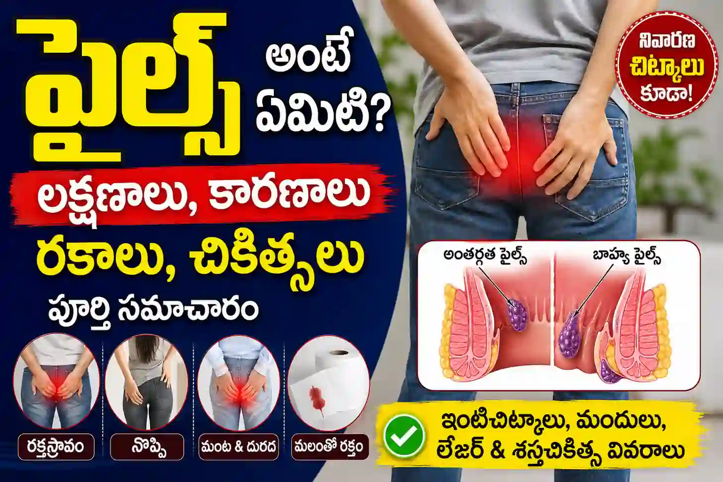 Piles అంటే ఏమిటి? రకాలు, లక్షణాలు మరియు చికిత్స | Complete Guide on Piles in Telugu